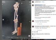 Pebalap Ini Alami Patah Tulang Paha Usai Crash di GP Mandalika, Bagaimana Nasibnya?