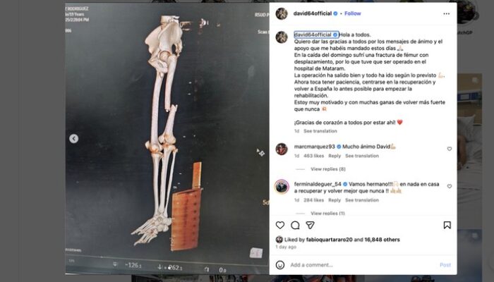 Pebalap Ini Alami Patah Tulang Paha Usai Crash di GP Mandalika, Bagaimana Nasibnya?