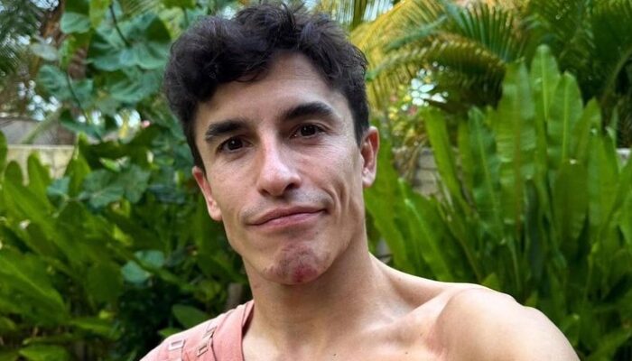 “Dokter Ungkap Cedera Serius Marc Marquez, Ada Sekrup Bengkok: Apakah Ini Akhir dari Era King of MotoGP?”